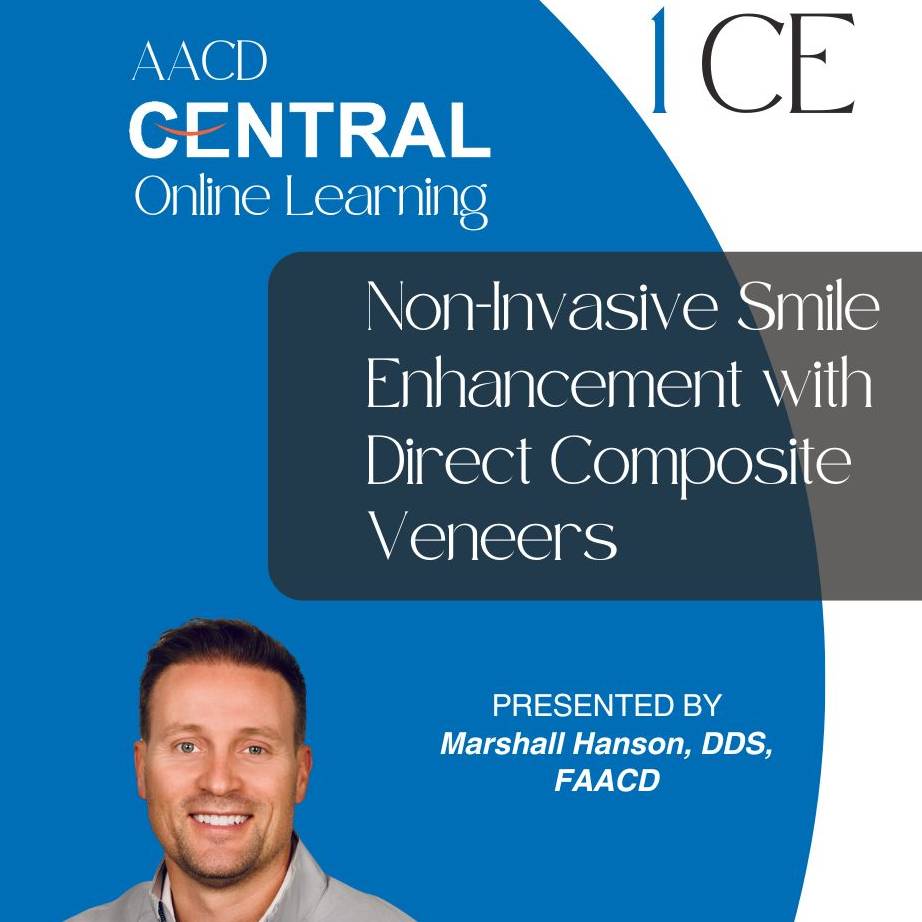 Non-Invasive Smile Enhancement with Direct Composite Veneers