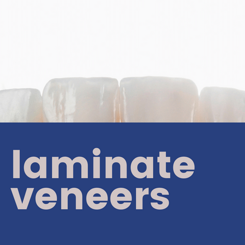 Laminate Veneers: A Step-by-Step Approach