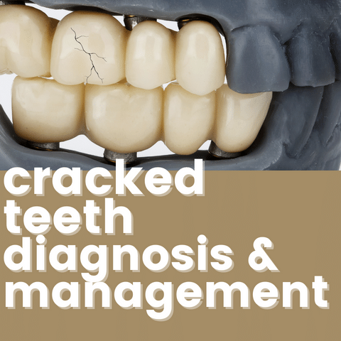 Cracked Teeth | Diagnosis and Management
