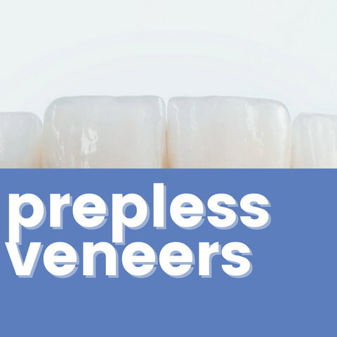 Prepless Veneers