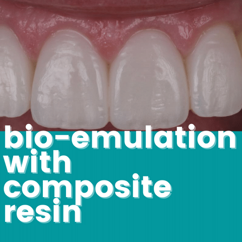 Bio-Emulation with Composite Resin
