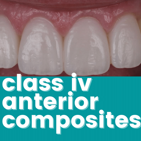Common Problems with Class IV Anterior Composites