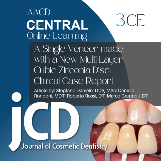 A Single Veneer made with a New Multi-Layer Cubic Zirconia Disc: Clinical Case Report