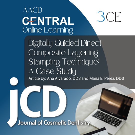 Digitally Guided Direct Composite Layering Stamping Technique: A Case Study