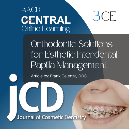 Orthodontic Solutions for Esthetic Interdental Papilla Management